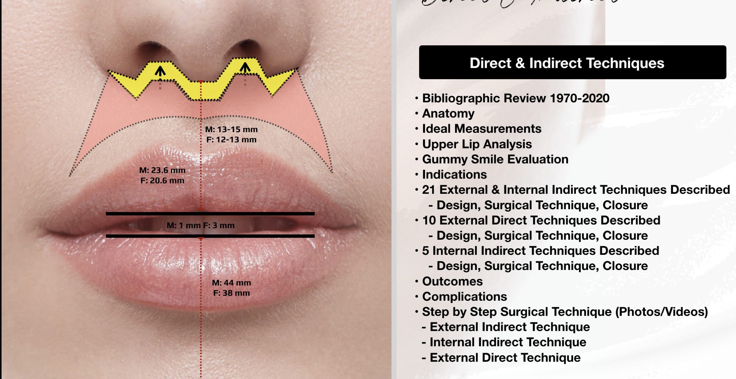 Lip lift surgery in Istanbul