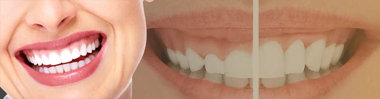 Best cosmetic dentist in Istanbul