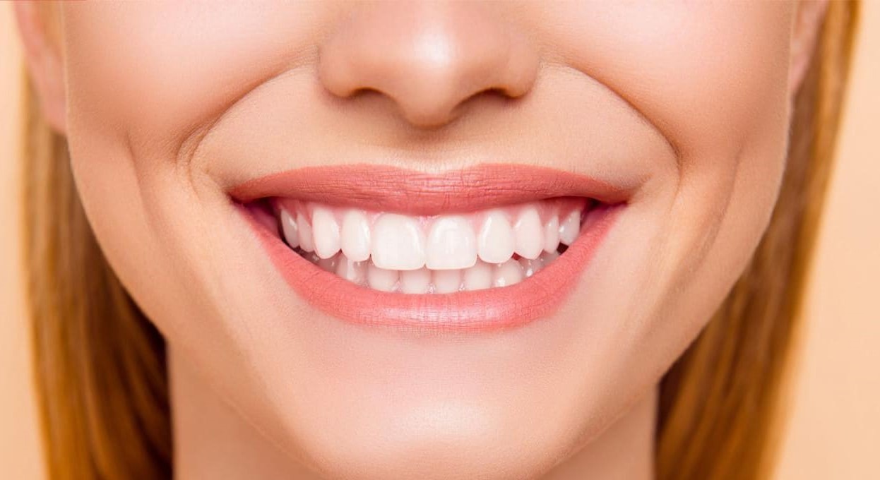 Dental composite in Türkiye 2023 cost Treatment in Istanbul